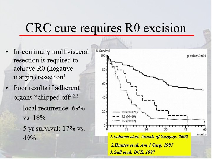 CRC cure requires R 0 excision • In-continuity multivisceral resection is required to achieve