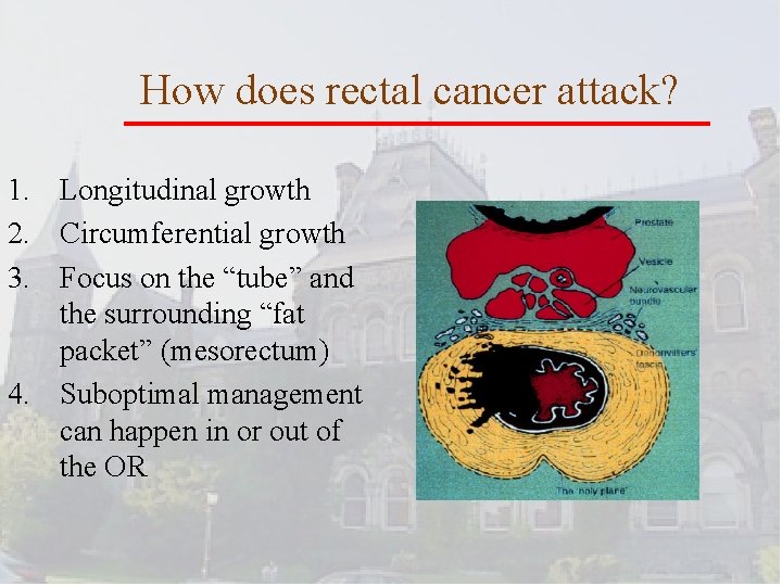How does rectal cancer attack? 1. Longitudinal growth 2. Circumferential growth 3. Focus on