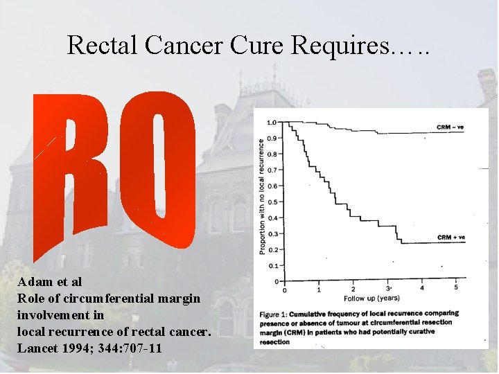 Rectal Cancer Cure Requires…. . Adam et al Role of circumferential margin involvement in