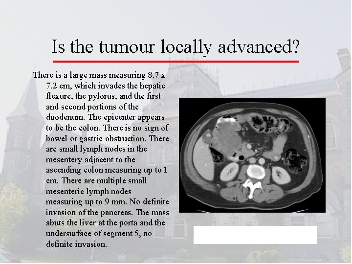 Is the tumour locally advanced? There is a large mass measuring 8. 7 x