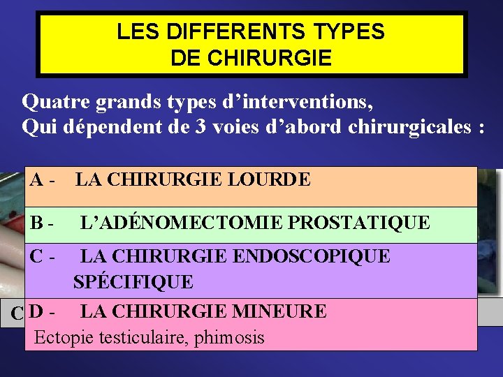 LES DIFFERENTS TYPES DE CHIRURGIE Quatre grands types d’interventions, Qui dépendent de 3 voies