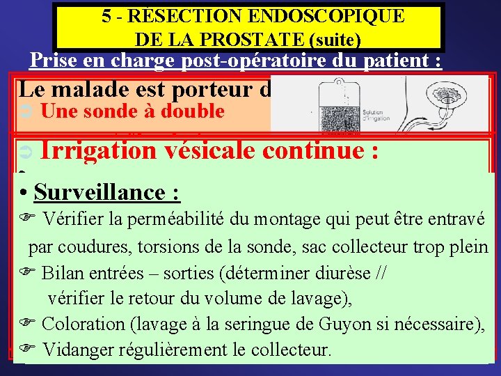  5 - RÉSECTION ENDOSCOPIQUE DE LA PROSTATE (suite) Prise en charge post-opératoire du