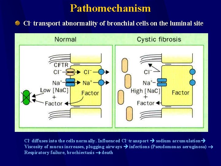Pathomechanism Cl- transport abnormality of bronchial cells on the luminal site Cl- diffuses into
