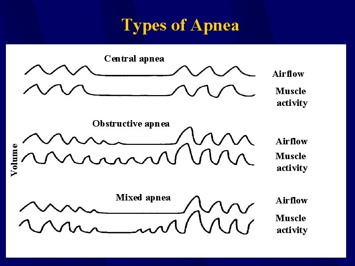 Types of Apnea Central apnea Airflow Muscle activity Obstructive apnea Volume Airflow Muscle activity