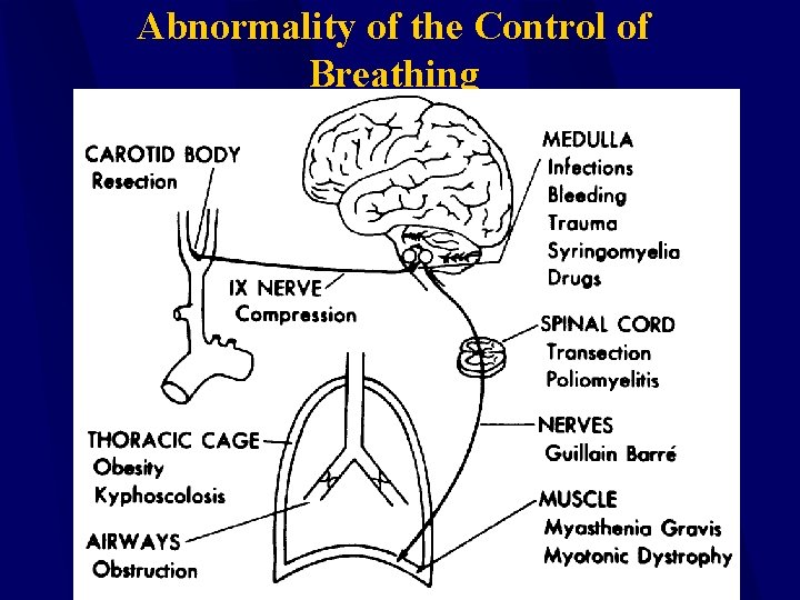 Abnormality of the Control of Breathing 