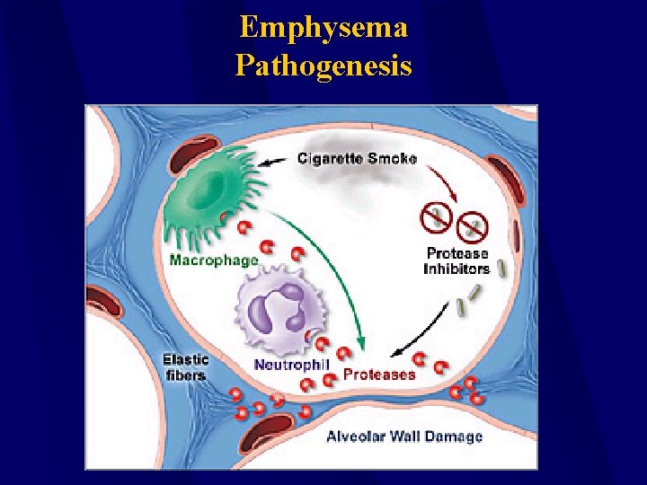 Emphysema Pathogenesis 