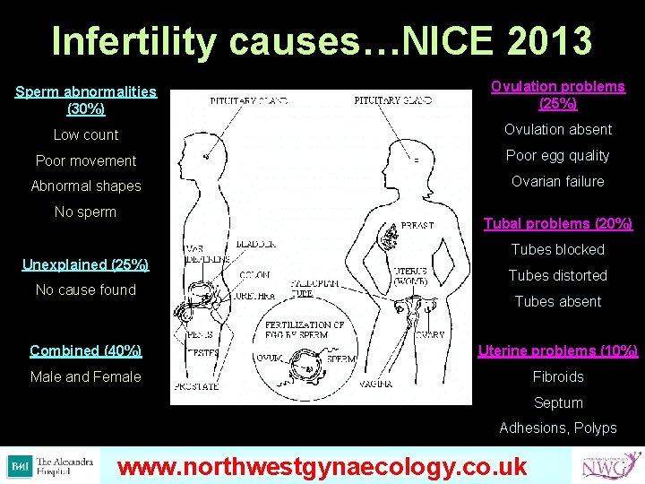 Infertility causes…NICE 2013 Sperm abnormalities (30%) Ovulation problems (25%) Low count Ovulation absent Poor