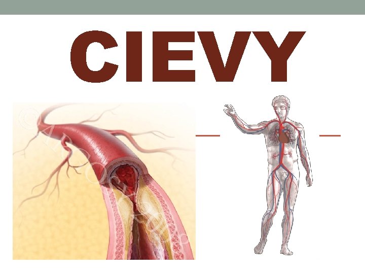 CIEVY 