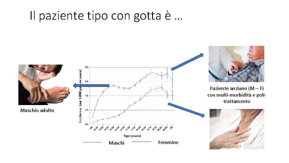 Il paziente tipo con gotta è … Paziente anziano (M – F) con multi-morbidità