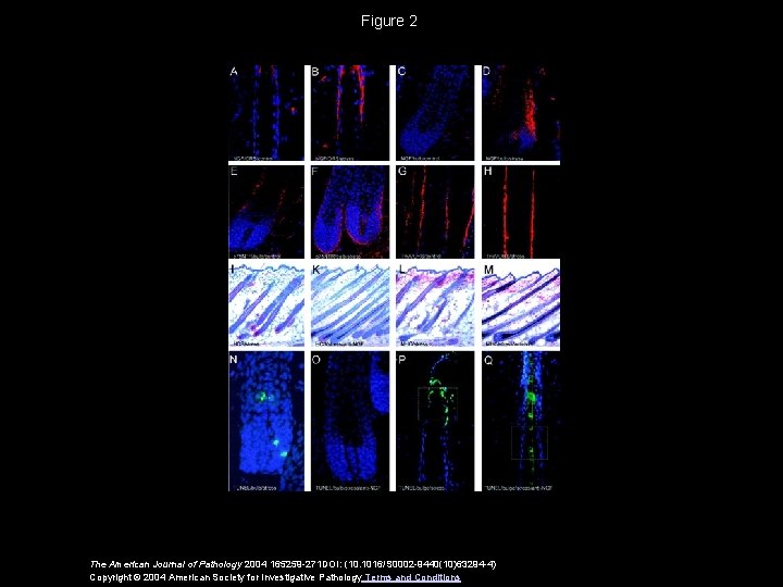 Figure 2 The American Journal of Pathology 2004 165259 -271 DOI: (10. 1016/S 0002