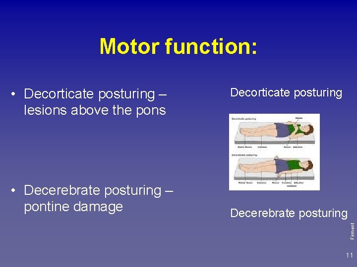 Motor function: • Decerebrate posturing – pontine damage Decorticate posturing Decerebrate posturing Firment •