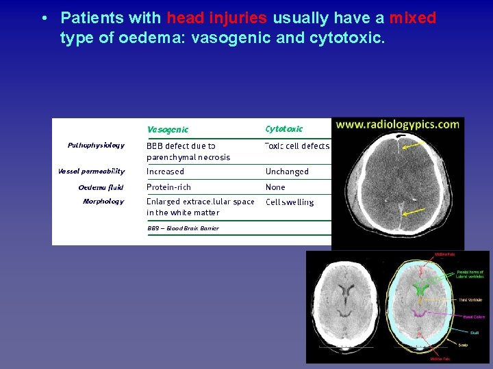 Firment • Patients with head injuries usually have a mixed type of oedema: vasogenic