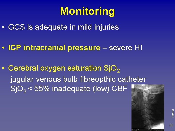 Monitoring • GCS is adequate in mild injuries • ICP intracranial pressure – severe