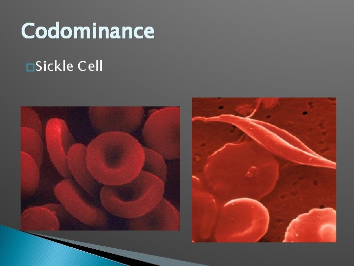 Codominance � Sickle Cell 