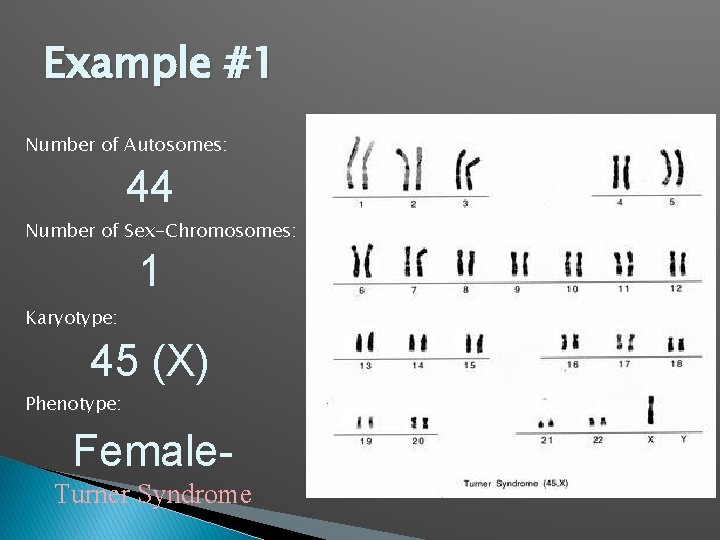 Example #1 Number of Autosomes: 44 Number of Sex-Chromosomes: 1 Karyotype: 45 (X) Phenotype: