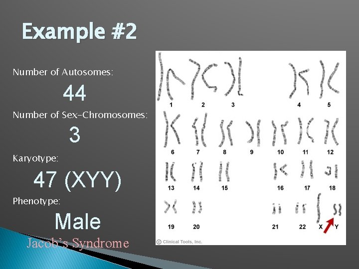 Example #2 Number of Autosomes: 44 Number of Sex-Chromosomes: 3 Karyotype: 47 (XYY) Phenotype: