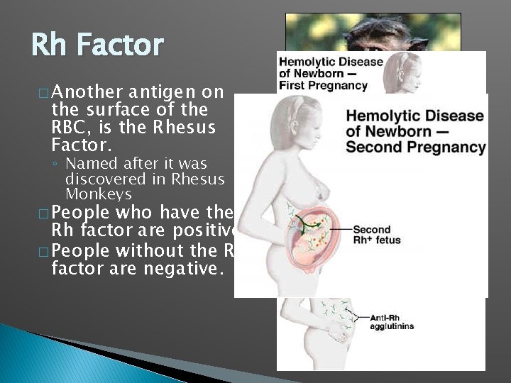 Rh Factor � Another antigen on the surface of the RBC, is the Rhesus