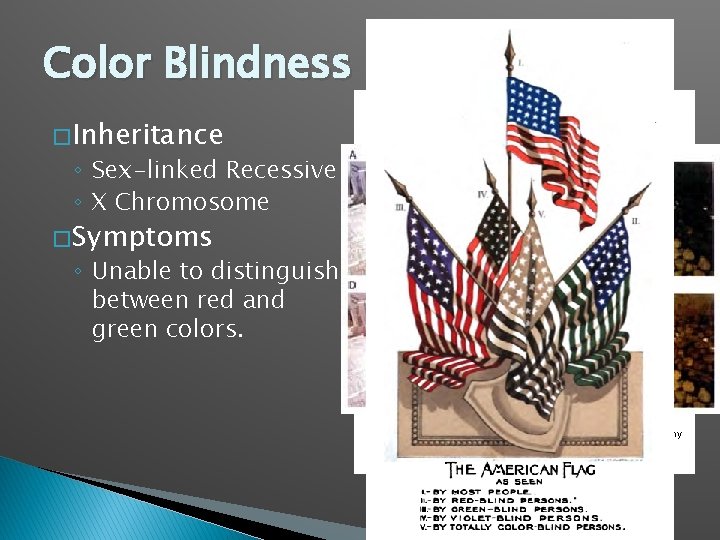 Color Blindness � Inheritance ◦ Sex-linked Recessive ◦ X Chromosome � Symptoms ◦ Unable