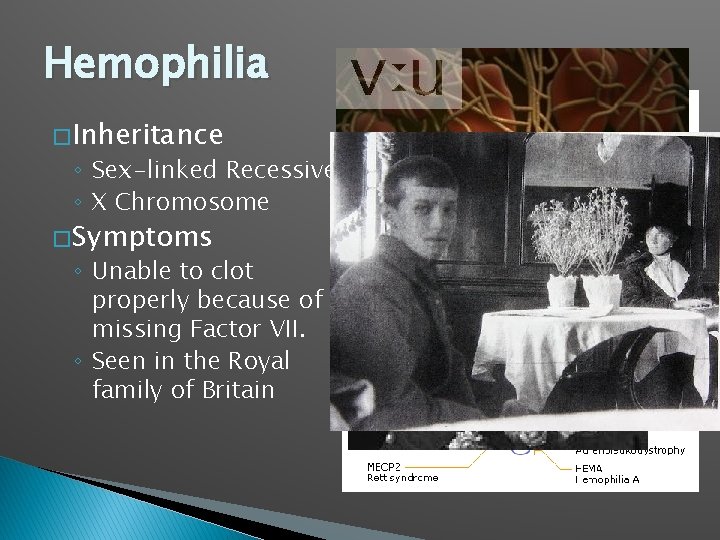 Hemophilia � Inheritance ◦ Sex-linked Recessive ◦ X Chromosome � Symptoms ◦ Unable to