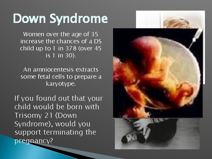 Down Syndrome Women over the age of 35 increase the chances of a DS