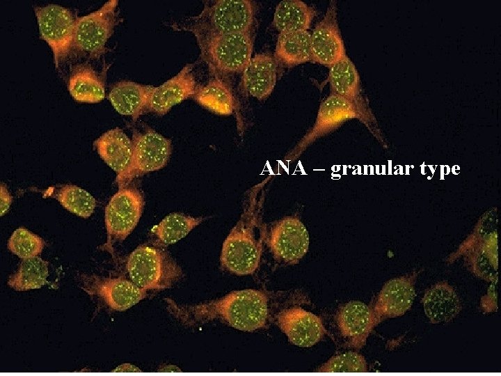 ANA – granular type 
