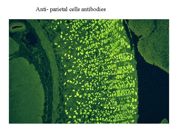 Anti- parietal cells antibodies 