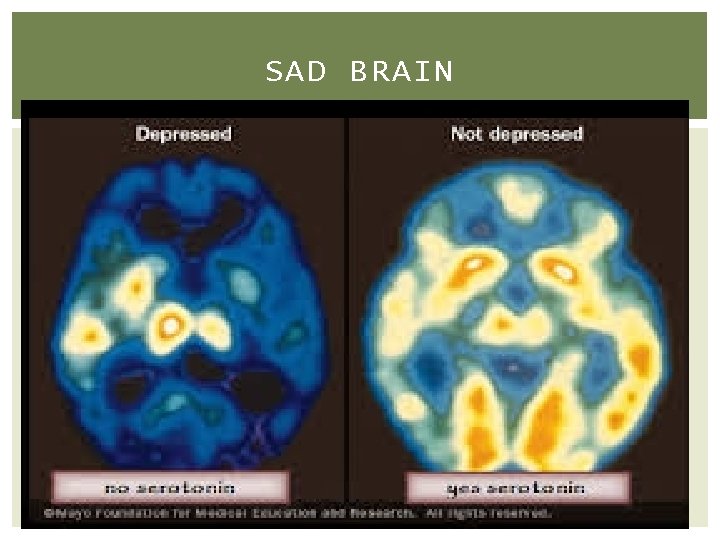 SAD BRAIN 