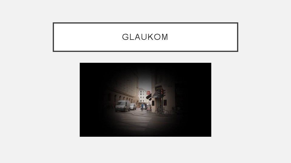 GLAUKOM 