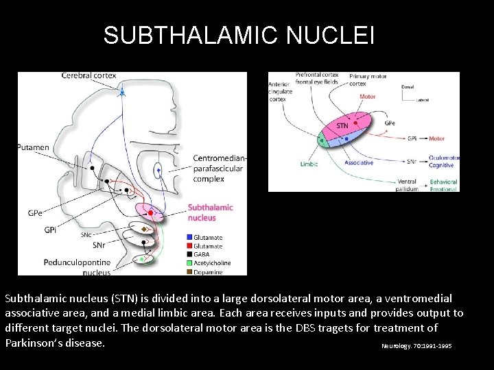 SUBTHALAMIC NUCLEI Subthalamic nucleus (STN) is divided into a large dorsolateral motor area, a