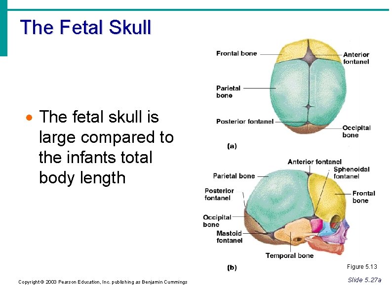 The Fetal Skull The fetal skull is large compared to the infants total body