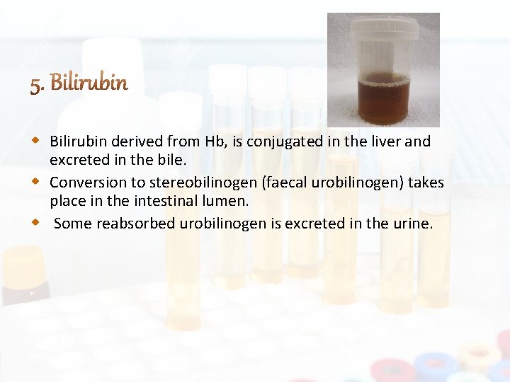  Bilirubin derived from Hb, is conjugated in the liver and excreted in the