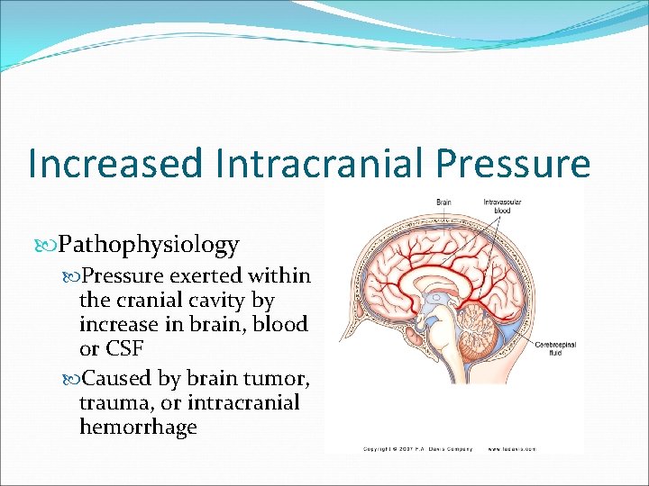 Increased Intracranial Pressure Pathophysiology Pressure exerted within the cranial cavity by increase in brain,