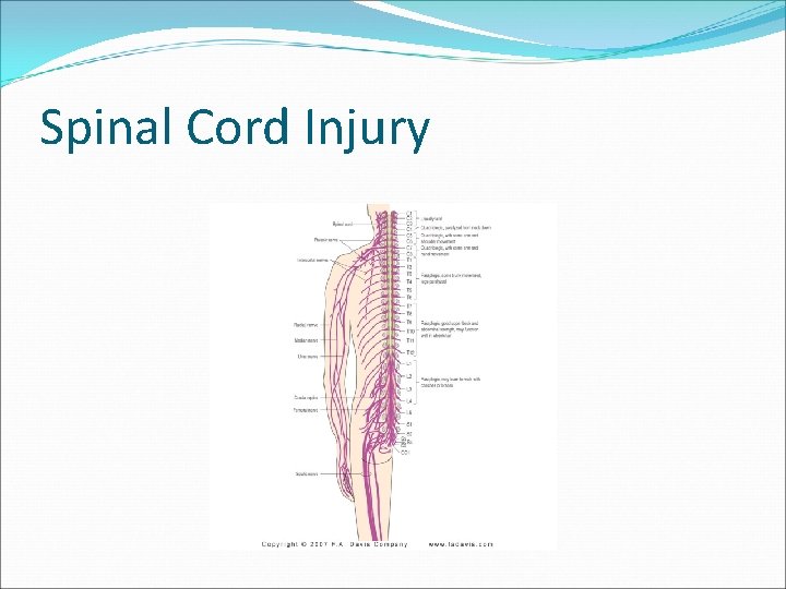 Spinal Cord Injury 
