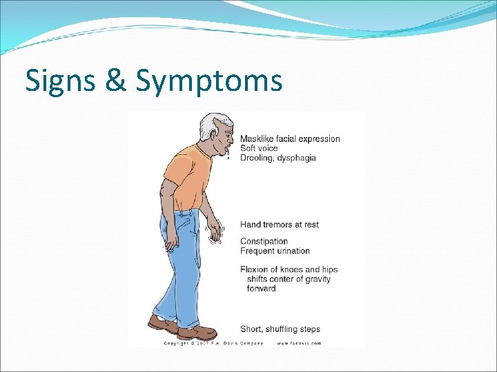 Signs & Symptoms 