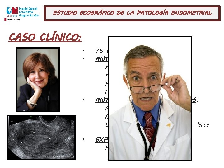 ESTUDIO ECOGRÁFICO DE LA PATOLOGÍA ENDOMETRIAL CASO CLÍNICO: • • 75 años. ANTECEDENTES PERSONALES: