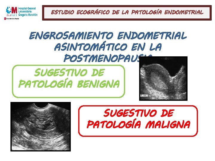 ESTUDIO ECOGRÁFICO DE LA PATOLOGÍA ENDOMETRIAL ENGROSAMIENTO ENDOMETRIAL ASINTOMÁTICO EN LA POSTMENOPAUSIA SUGESTIVO DE
