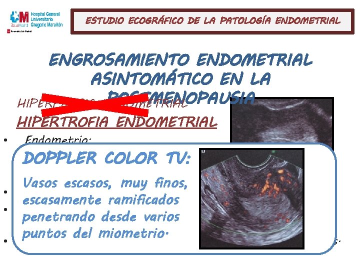 ESTUDIO ECOGRÁFICO DE LA PATOLOGÍA ENDOMETRIAL ENGROSAMIENTO ENDOMETRIAL ASINTOMÁTICO EN LA POSTMENOPAUSIA HIPERPLASIA ENDOMETRIAL