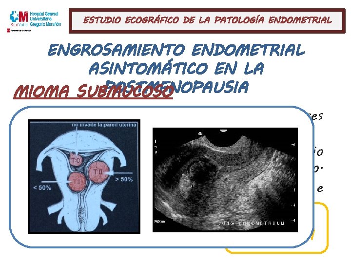 ESTUDIO ECOGRÁFICO DE LA PATOLOGÍA ENDOMETRIAL ENGROSAMIENTO ENDOMETRIAL ASINTOMÁTICO EN LA POSTMENOPAUSIA MIOMA SUBMUCOSO