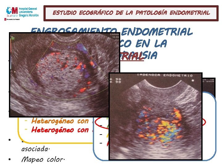 ESTUDIO ECOGRÁFICO DE LA PATOLOGÍA ENDOMETRIAL ENGROSAMIENTO ENDOMETRIAL ASINTOMÁTICO EN LA CARCINOMAPOSTMENOPAUSIA ENDOMETRIAL GROSOR