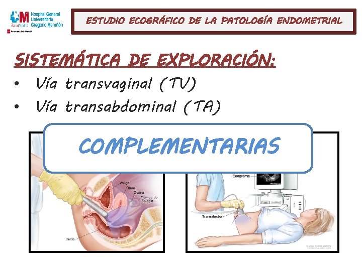 ESTUDIO ECOGRÁFICO DE LA PATOLOGÍA ENDOMETRIAL SISTEMÁTICA DE EXPLORACIÓN: • Vía transvaginal (TV) •