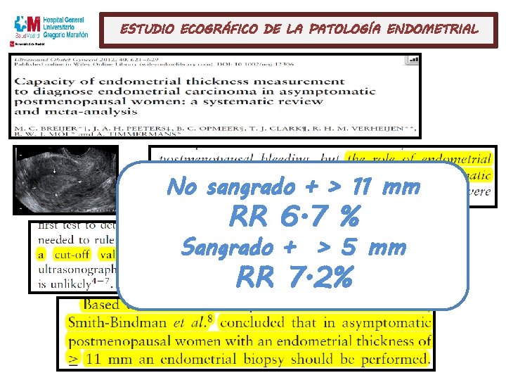 ESTUDIO ECOGRÁFICO DE LA PATOLOGÍA ENDOMETRIAL No sangrado + > 11 mm RR 6.