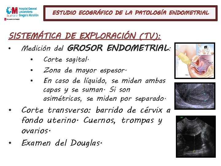 ESTUDIO ECOGRÁFICO DE LA PATOLOGÍA ENDOMETRIAL SISTEMÁTICA DE EXPLORACIÓN (TV): • • • Medición