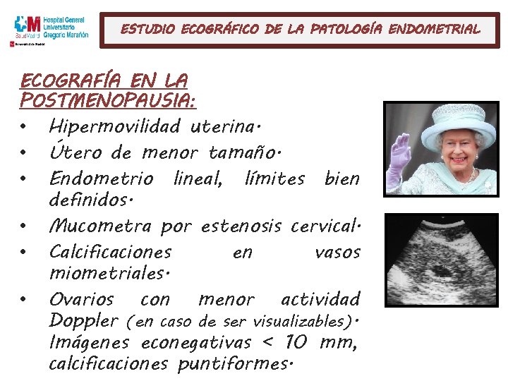 ESTUDIO ECOGRÁFICO DE LA PATOLOGÍA ENDOMETRIAL ECOGRAFÍA EN LA POSTMENOPAUSIA: • • • Hipermovilidad
