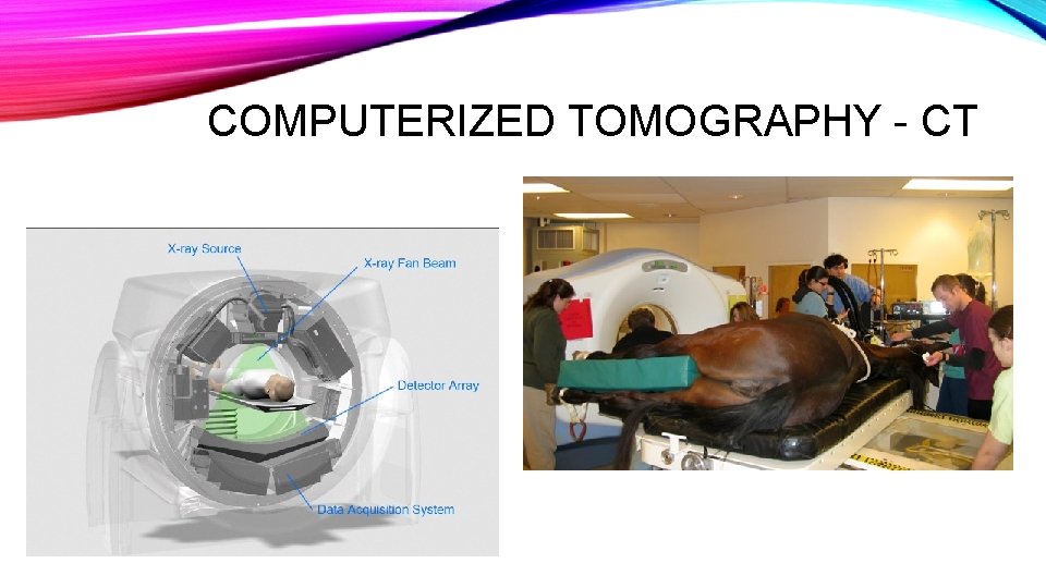 COMPUTERIZED TOMOGRAPHY - CT COMPUTERIZED TOMOGRAPHY - CT