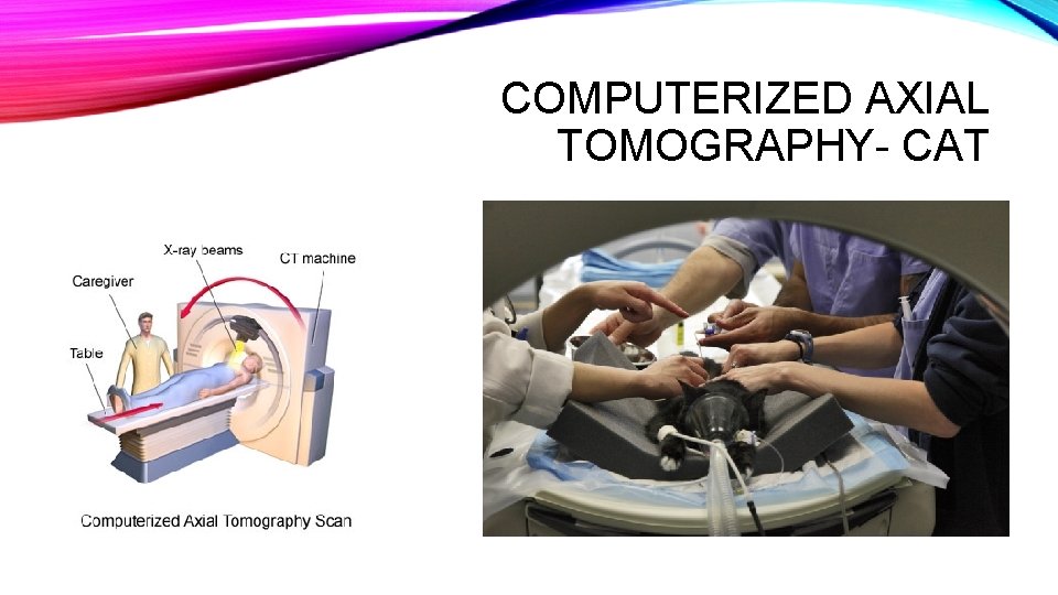 COMPUTERIZED AXIAL TOMOGRAPHY- CAT COMPUTERIZED AXIAL TOMOGRAPHY- CAT