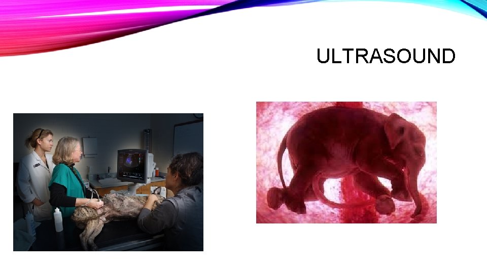 ULTRASOUND ULTRASOUND