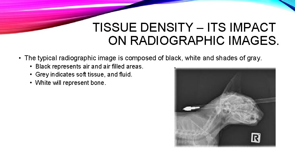 TISSUE DENSITY – ITS IMPACT ON RADIOGRAPHIC IMAGES. • The typical radiographic image is TISSUE DENSITY – ITS IMPACT ON RADIOGRAPHIC IMAGES. • The typical radiographic image is