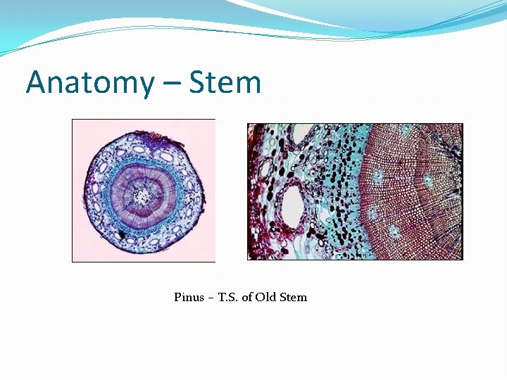 Anatomy – Stem Pinus – T. S. of Old Stem 