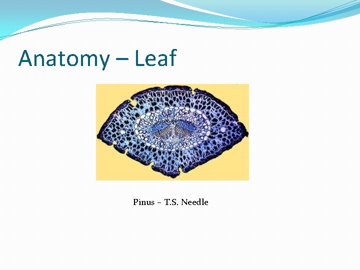 Anatomy – Leaf Pinus – T. S. Needle 