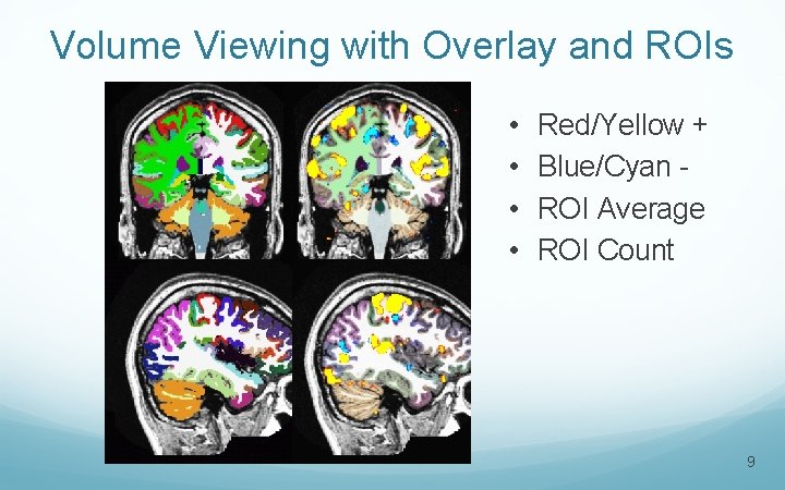 Volume Viewing with Overlay and ROIs • • Red/Yellow + Blue/Cyan ROI Average ROI